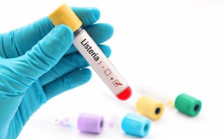 Listeria, massima attenzione al cibo. Le buone pratiche per limitarne i rischi